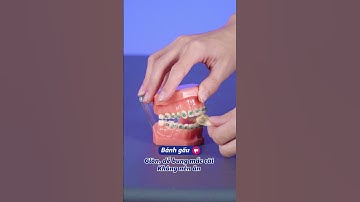 Niềng răng nên hay không nên ăn gì ? | Lạc Việt Intech Niềng Răng #shorts