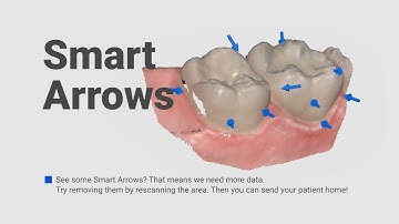Medit i700 | Better for Patients, Easier for Dentists | Smart Software | Smart Arrows