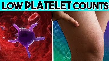 Causes, Signs and symptoms of Low platelet count |Thrombocytopenia | Low Platelet count