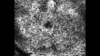 生体共焦点レーザー顕微鏡 細胞レベルの皮膚構造観察に