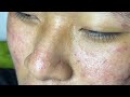 Satisfying and Relaxation with SURI NGUYEN Beauty Spa Video #284