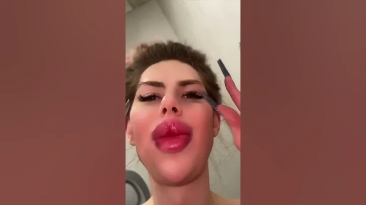 Surgery with zero euro 😅🤷‍♀️ #shorts #funny #comedy