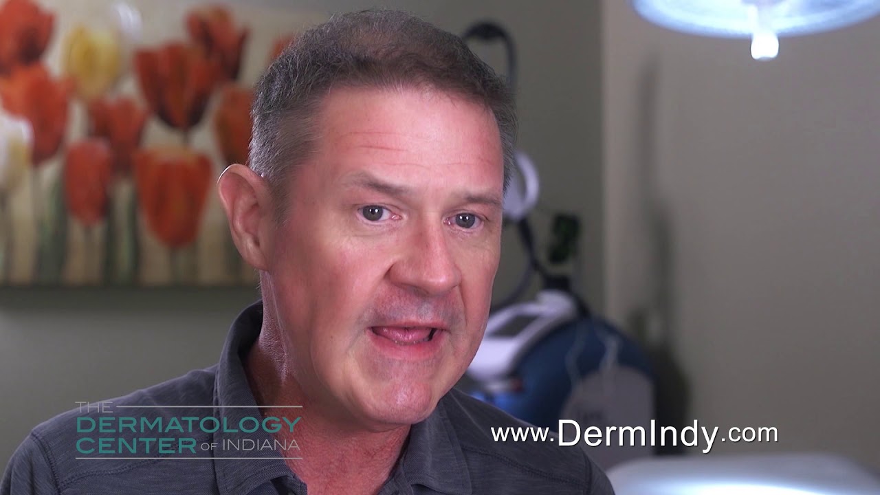 The Dermatology Center of Indiana Skin Care YouTube