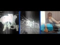 Chirayu hospital  joints replacement in ahmedabad gujarat india