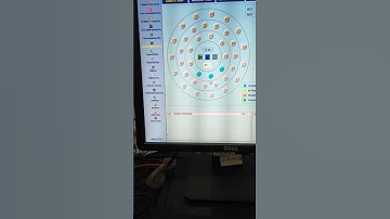 Control and calibration program and run in Erba EM 200 @medicallabtechnologysajal6903