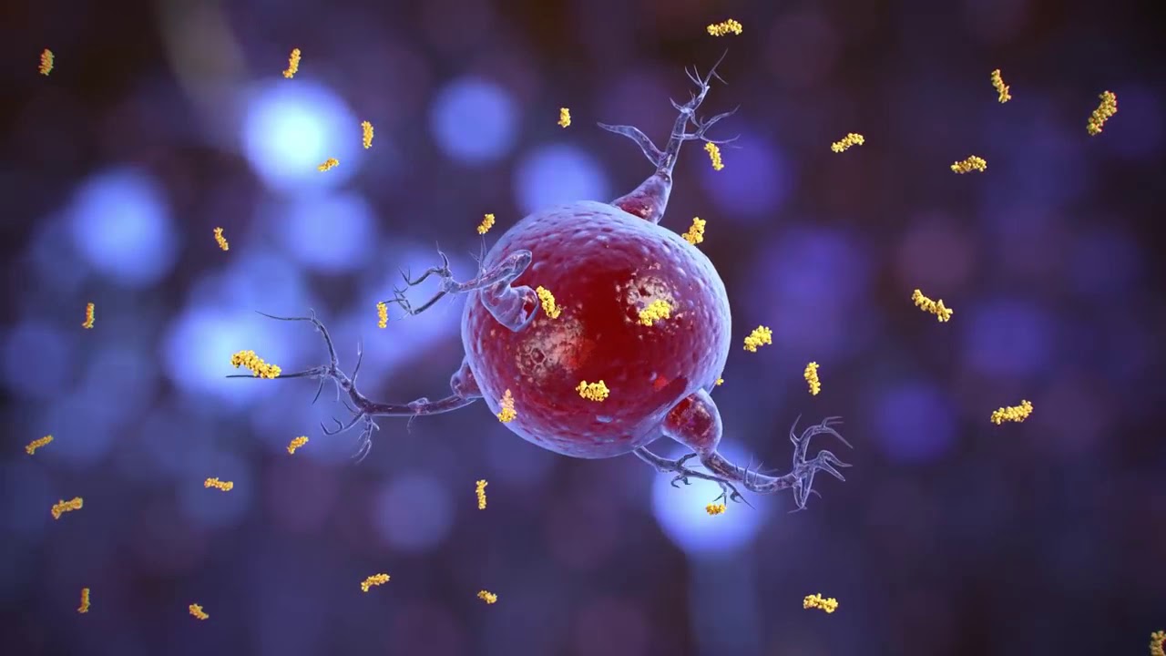 Light based therapy for Alzheimer's disease YouTube