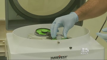 Stanford Doctors Regenerate Knee Cartilage Using Patients
