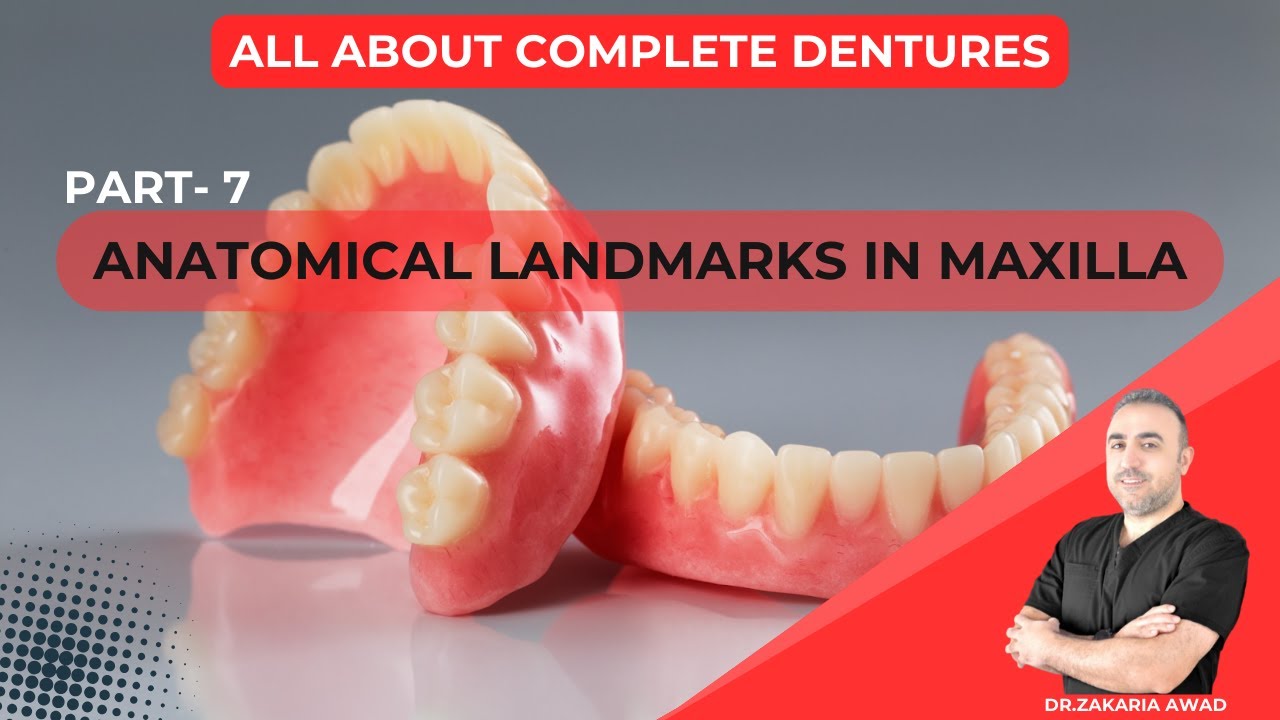7- العلامات التشريحية الهامة في الفك العلوي - ANATOMICAL LANDMARKS IN MAXILLA