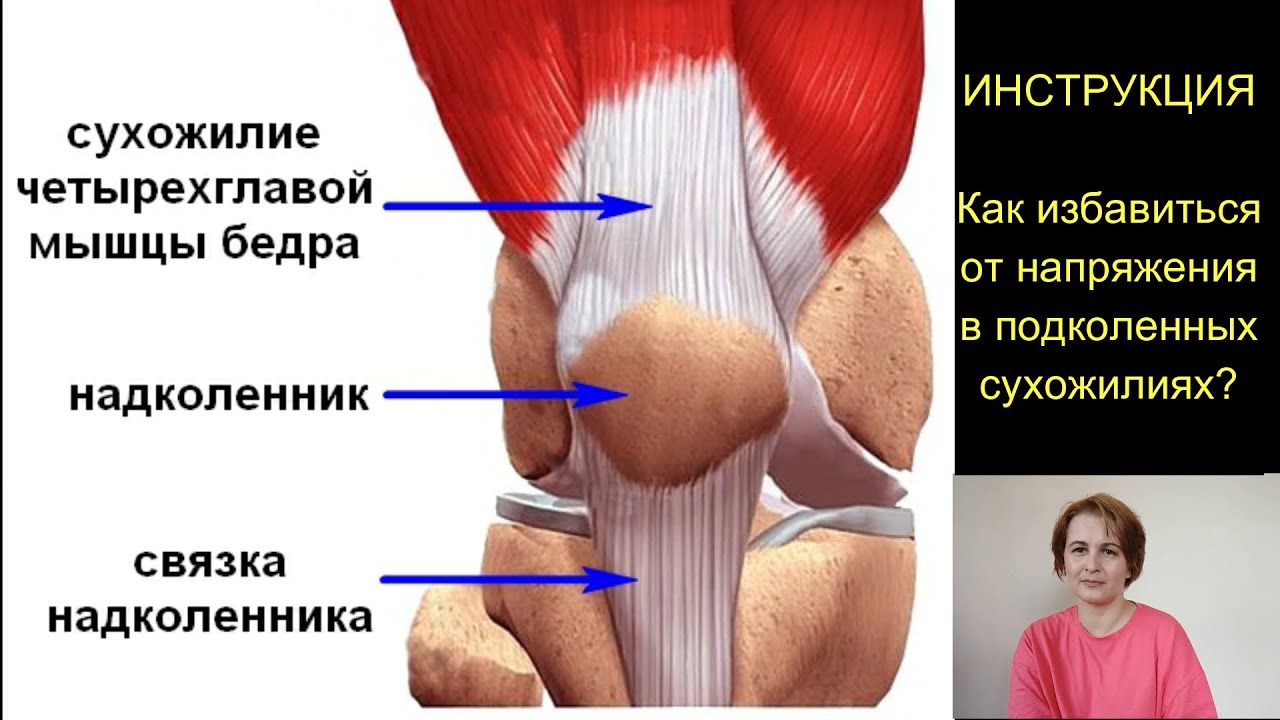 Тендинит коленных связок