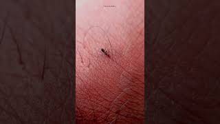 Found This Tiny Friend On My Foot