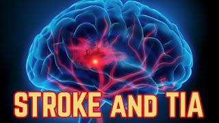 Stroke and TIA (updated 2023) - CRASH! Medical Review Series