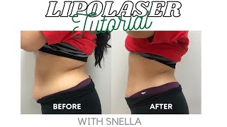 Lipolaser Tutorial | How To Use Lipolaser | Snella Body Contouring Lipolaser