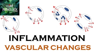 INFLAMMATION Part 1: General concepts, types , Vascular changes in Acute inflammation