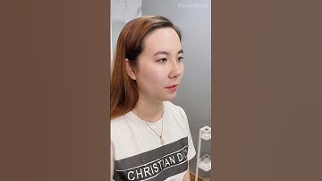 Nâng Mũi Cấu Trúc 4D - Sở Hữu Dáng Mũi Đẹp Mọi Góc Nhìn