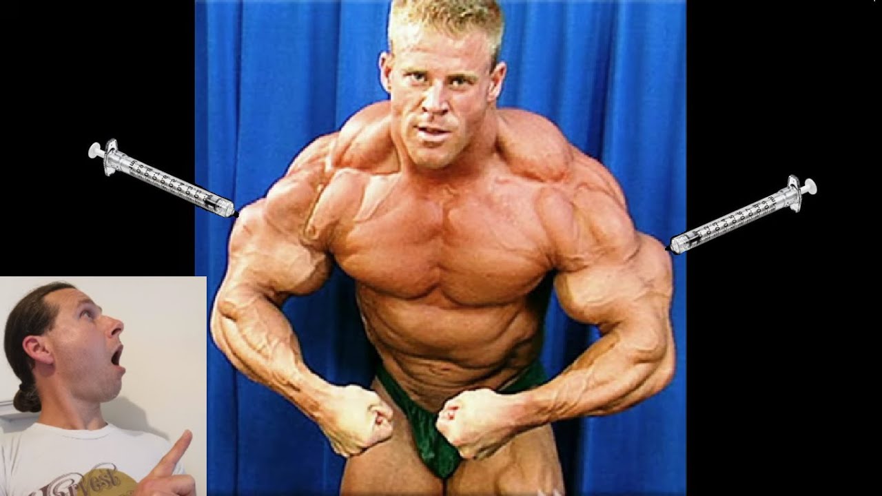 The Worst Cases of Synthol Abuse in Bodybuilding 