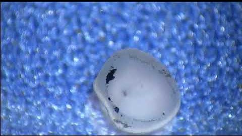 Isolating the neural retina from a very tiny mouse eye.