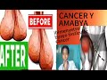 TESTICULAR CANCER PATIENT If You Experience These Symptoms See A Doctor Immediately TESTICULAR CANCER PATIENT If You Experience These Symptoms See A Doctor Immediately