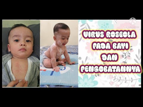 Video: Apakah saya perlu pergi ke dokter untuk roseola?