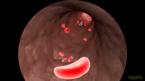 NANOBOTS IN BLOODSTREAM