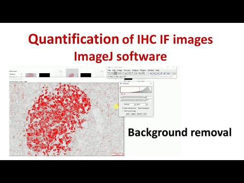 Video: Cum se reduce colorarea de fundal în imunofluorescență?