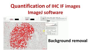 Quantification of Immunohistochemistry images using ImageJ | How to remove background in ImageJ