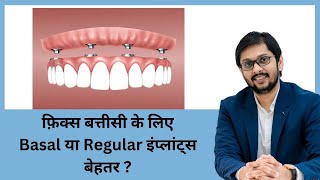 BASAL Implant vs Conventional Implants  COMPLETE INFORMATION | हिंदी Dr Ankit