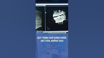 Quy trình nhổ răng khôn I Nha Khoa Smile HT #răngkhôn #smileht #nhakhoa #shorts