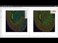 How to analyze 10x visium spatial gene expression data