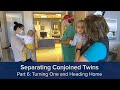 Separating Conjoined Twins Part 6: Turning One and Heading Home