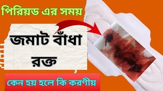 মাসিকের সময় জমাট বাঁধা রক্ত কেন আসে | জমাট বাঁধা রক্ত কোন রোগ এর লক্ষণ ও আসলে কি করবে | নারীকথা