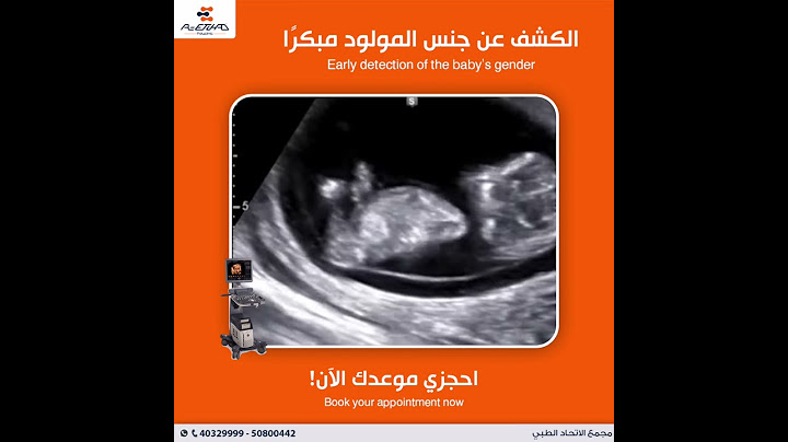 الكشف عن جنس المولود