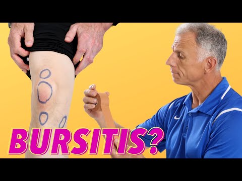 What Is Causing Your Knee Pain? Bursitis? How To Tell?