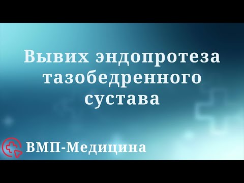 Вывих эндопротеза тазобедренного сустава | ВМП-Медицина