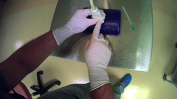 6 Holding The Ultrasound Probe