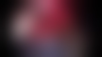 Anterior Component Separation ALBANESE-TECHNIQUE