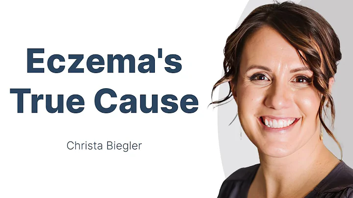 Whats The Real Cause of Eczema with Christa Biegler