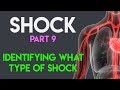 Understanding Shock: Types and Identification