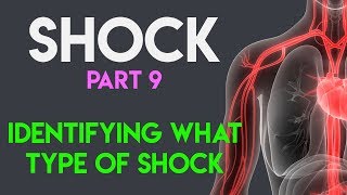 Identifying What Type Shock | Shock (Part 9)