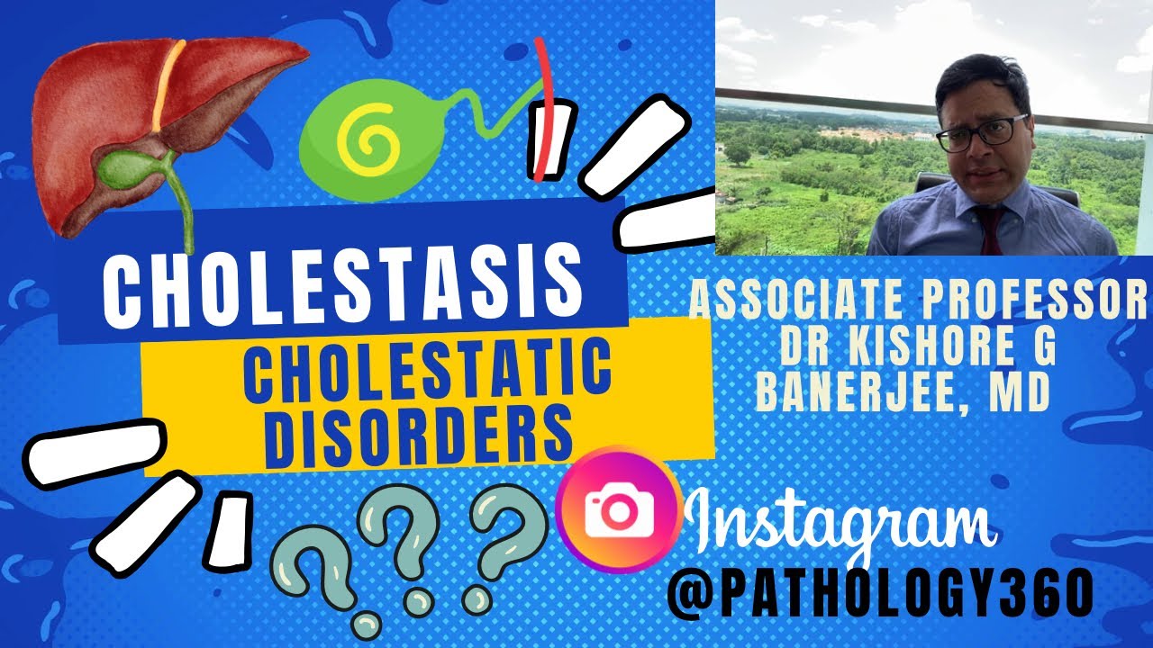 Cholestasis and Cholestatic Disorders Simplified. IntraHepaticVs