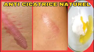 Éliminez n’importe quel type de cicatrice de votre corps avec ce remède naturel