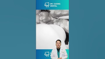 Nhổ Răng Dại Sẽ Như Thế Nào |Dr Cường Offical