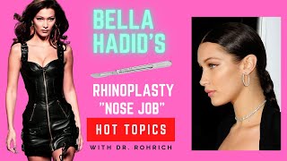 Hot Topics Bella Hadid's Rhinoplasty with Dr  Rohrich