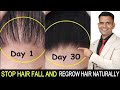 1 Best Medicine To Stop Hair Fall | Stop Hair Fall And Regrow Hair Naturally