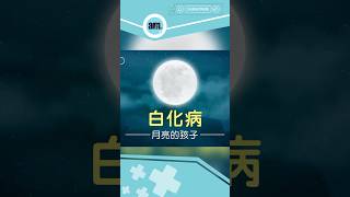 什麼是白化病？醫生解析白化病的發病概率｜醫SICK醫識 #AM730 #白化病 #albino