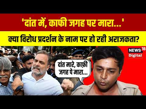 'दांत में, काफी जगह पर मारा...' दिल्ली पुलिस ने इंडिया ब्लॉक प्रोटेस्ट के दौरान हुए हमले को याद किया