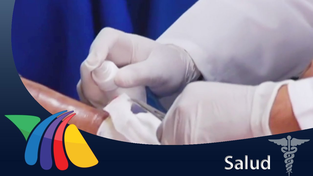 medicamento para cicatrizar heridas de diabeticos