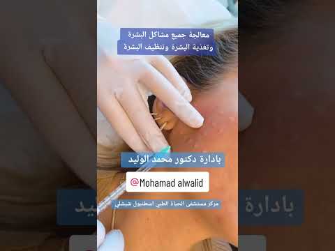 حقن البلازما للوجه في تركيا 2023