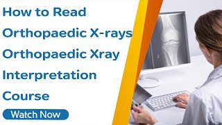 How to Read Orthopaedic X-rays - Orthopaedic Xray Interpretation Course screenshot 3