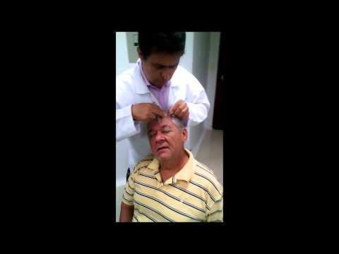 ATAXIA CEREBELOSA Y ACUPUNTURA LÁZARO COLOMBIA, BUCARAMANGA http://www.tumedicinaintegrativa.com.co/