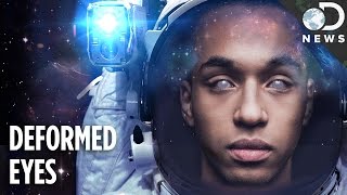 Could Space Travel Make You Go Blind? Could Space Travel Make You Go Blind?